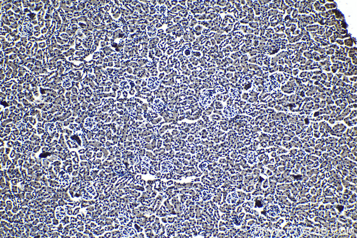 Immunohistochemical analysis of paraffin-embedded mouse kidney tissue slide using KHC1377 (CCAR1 IHC Kit).