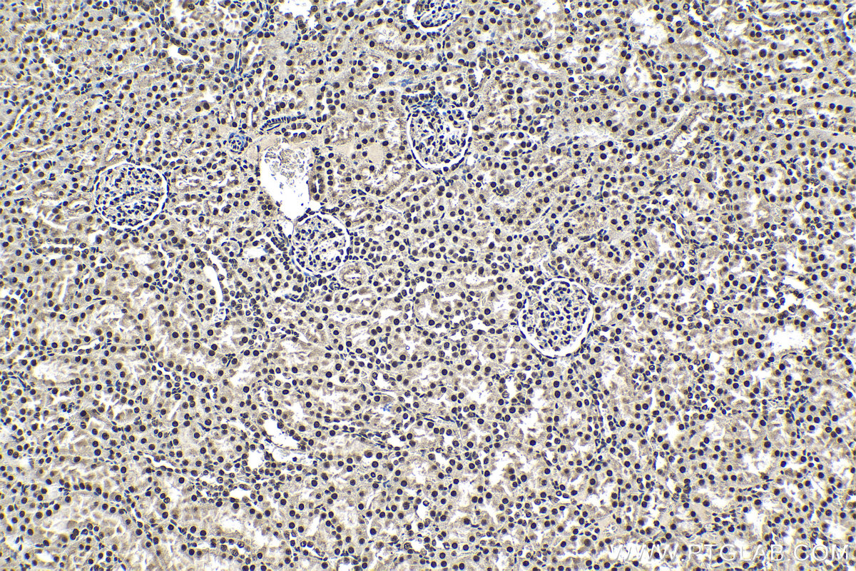 Immunohistochemical analysis of paraffin-embedded rat kidney tissue slide using KHC1377 (CCAR1 IHC Kit).