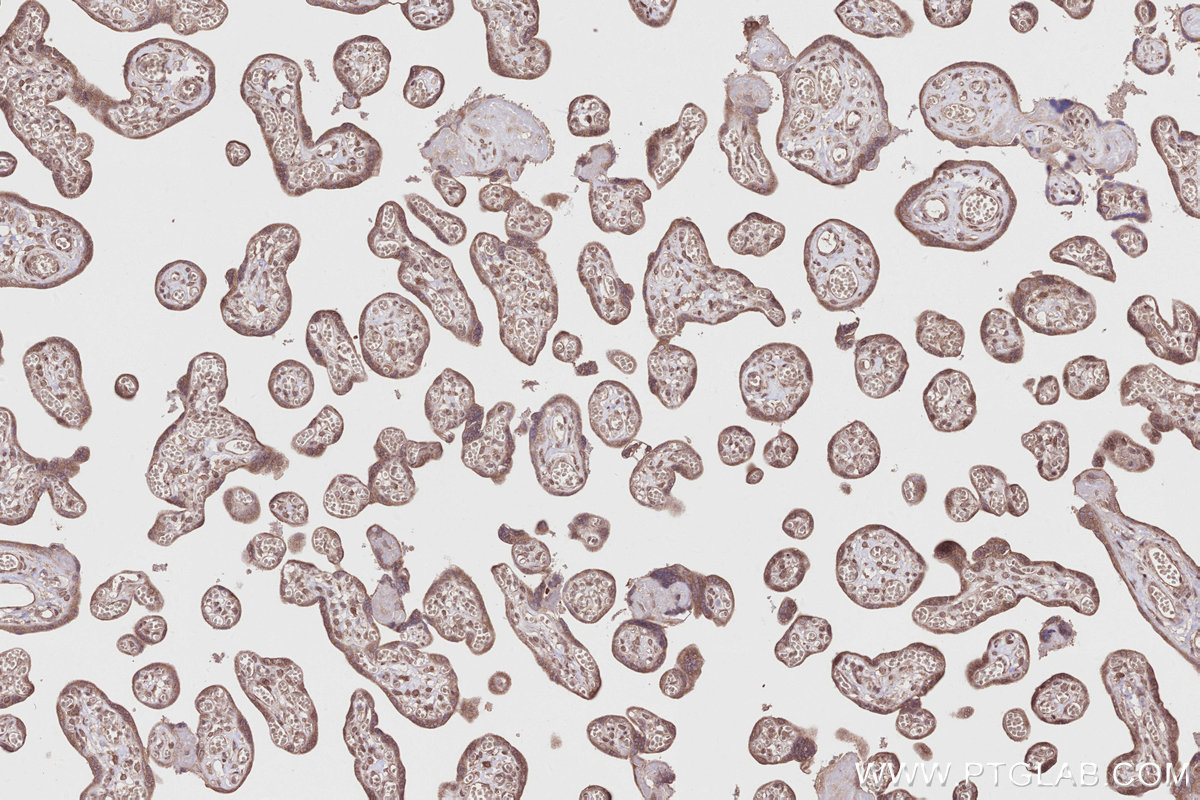 Immunohistochemical analysis of paraffin-embedded human placenta tissue slide using KHC2810 (CCDC115 IHC Kit).