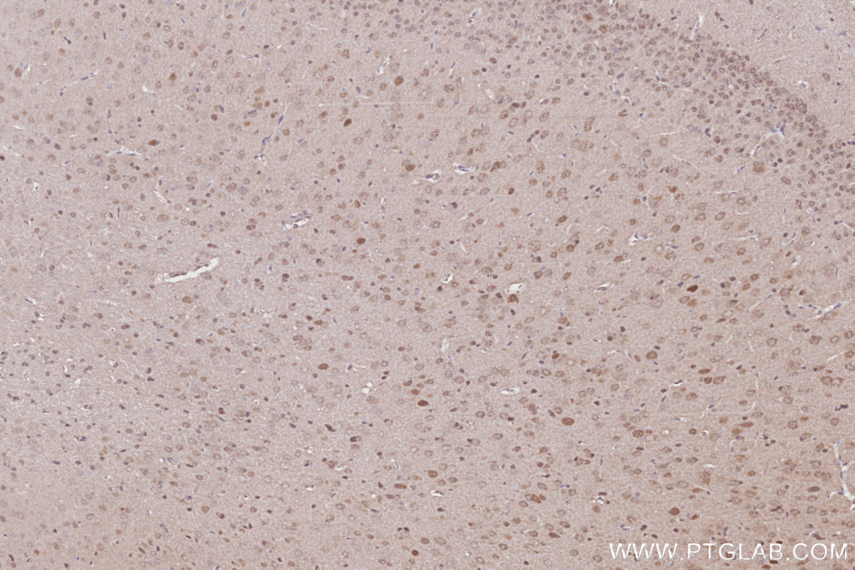 Immunohistochemical analysis of paraffin-embedded rat brain tissue slide using KHC2810 (CCDC115 IHC Kit).