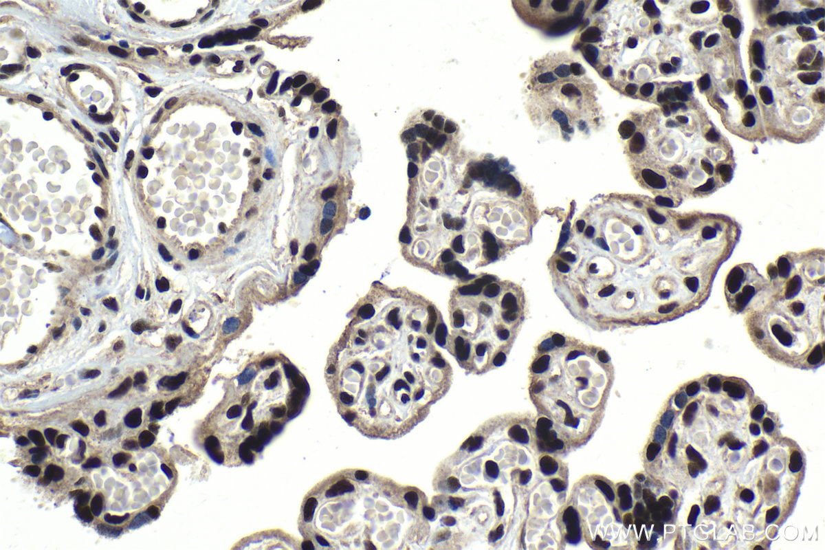 Immunohistochemical analysis of paraffin-embedded human placenta tissue slide using KHC1044 (CCDC12 IHC Kit).