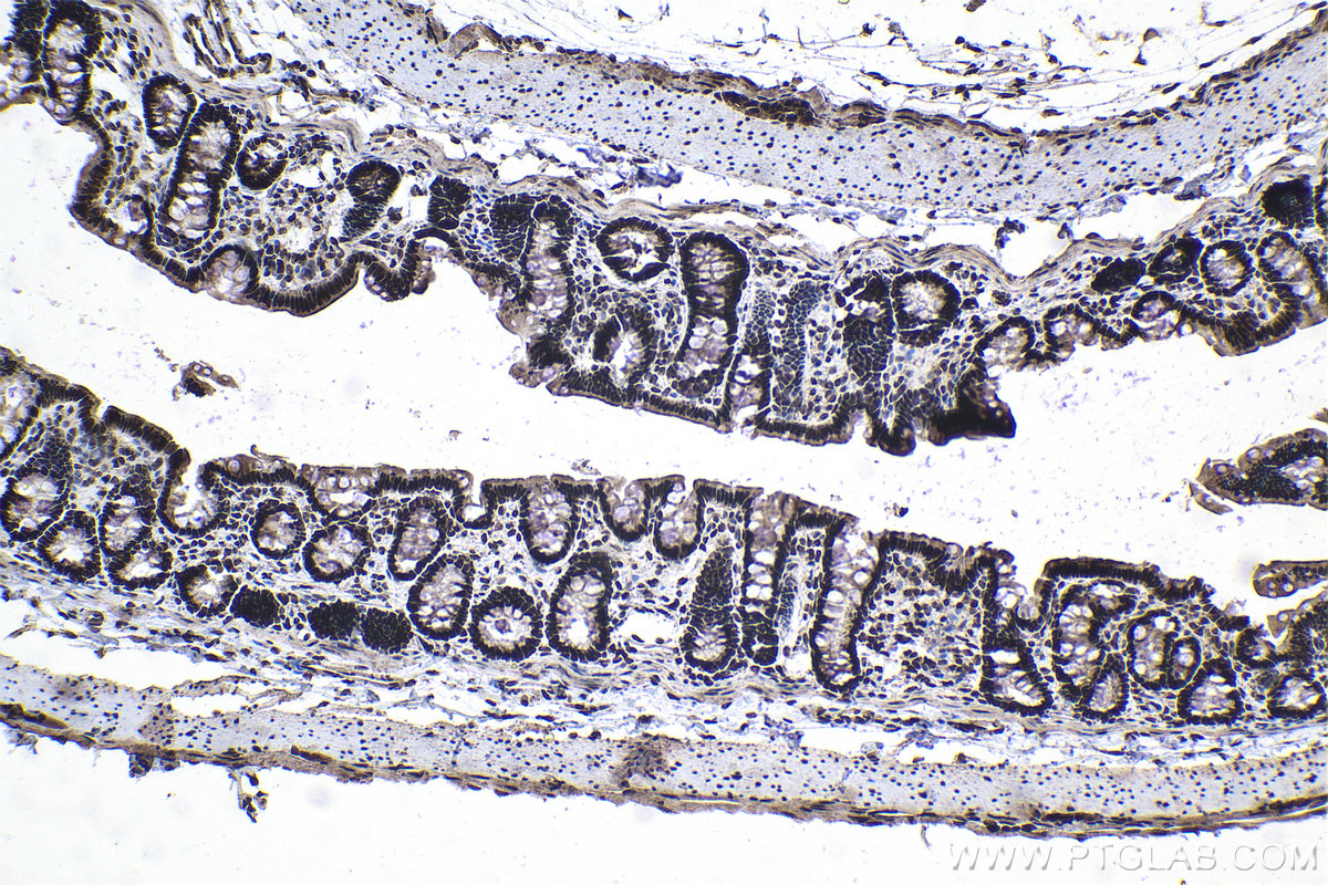 Immunohistochemical analysis of paraffin-embedded rat colon tissue slide using KHC1044 (CCDC12 IHC Kit).