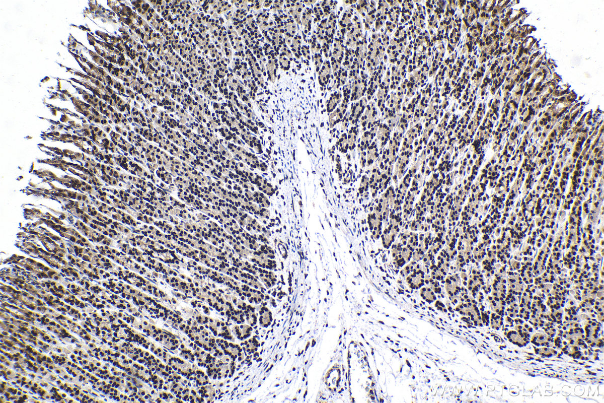 Immunohistochemical analysis of paraffin-embedded rat stomach tissue slide using KHC1044 (CCDC12 IHC Kit).