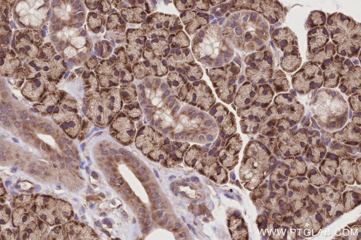 Immunohistochemical analysis of paraffin-embedded rat salivary gland tissue slide using KHC2784 (CCDC124 IHC Kit).