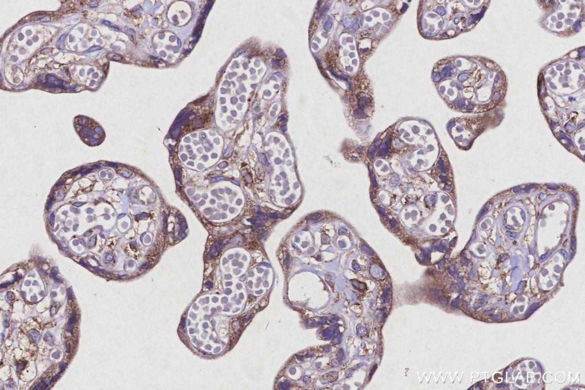 Immunohistochemical analysis of paraffin-embedded human placenta tissue slide using KHC2919 (CCDC134 IHC Kit).