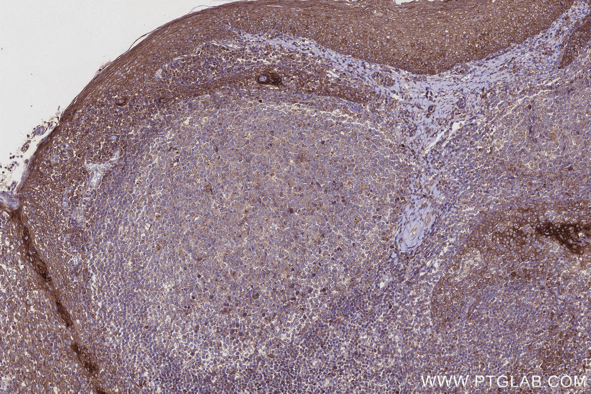 Immunohistochemical analysis of paraffin-embedded human tonsillitis tissue slide using KHC2919 (CCDC134 IHC Kit).