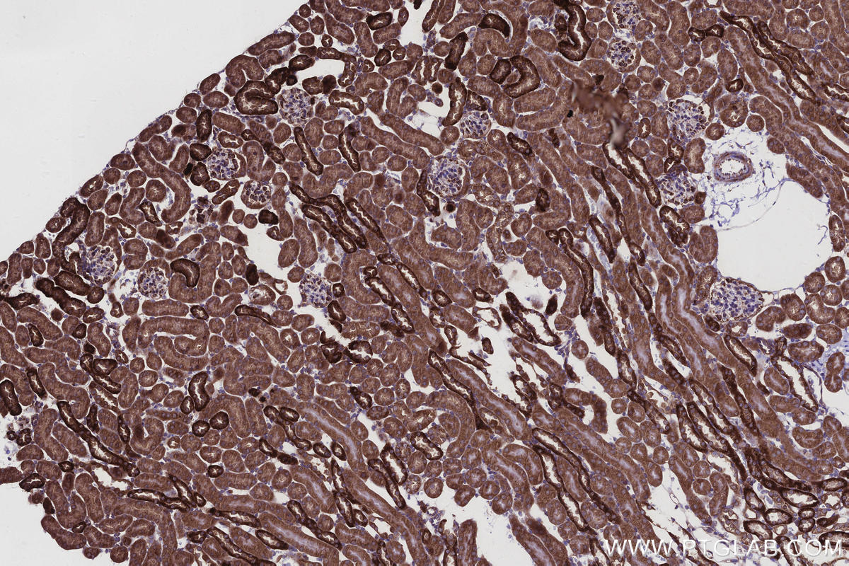 Immunohistochemical analysis of paraffin-embedded mouse kidney tissue slide using KHC2919 (CCDC134 IHC Kit).