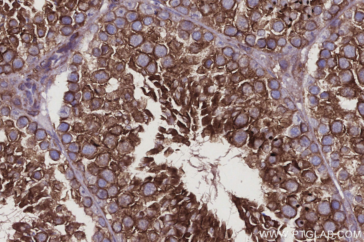 Immunohistochemical analysis of paraffin-embedded mouse testis tissue slide using KHC2919 (CCDC134 IHC Kit).
