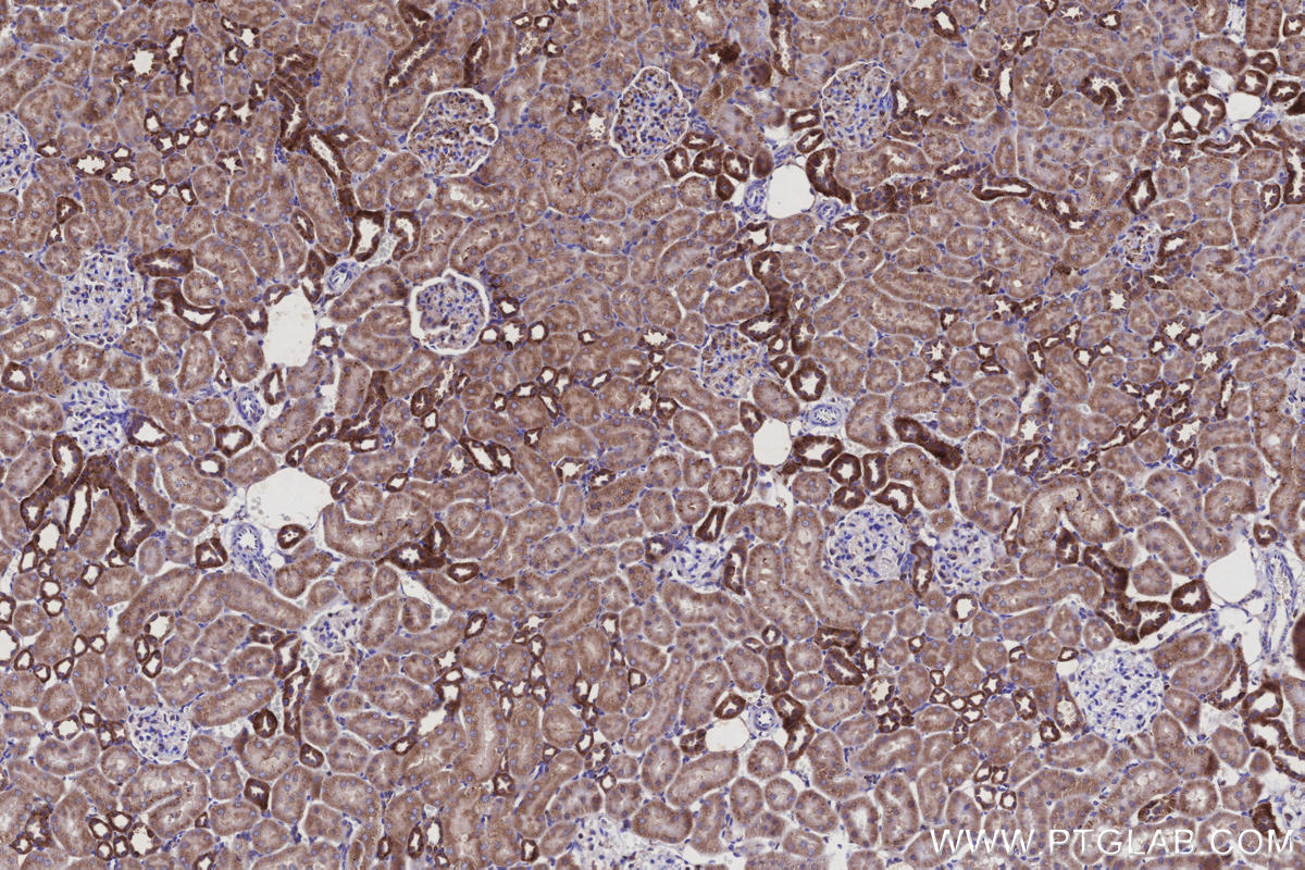Immunohistochemical analysis of paraffin-embedded rat kidney tissue slide using KHC2919 (CCDC134 IHC Kit).