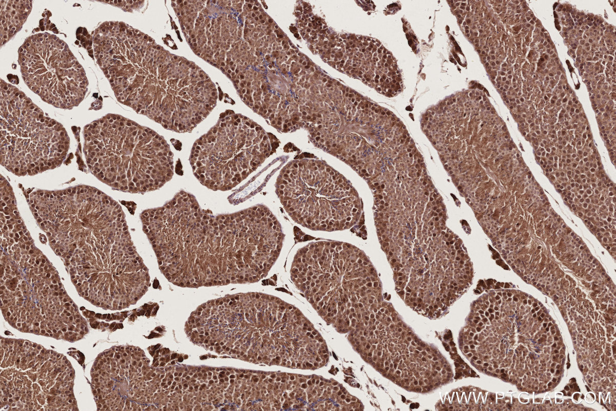 Immunohistochemical analysis of paraffin-embedded mouse testis tissue slide using KHC2787 (CCDC99 IHC Kit).