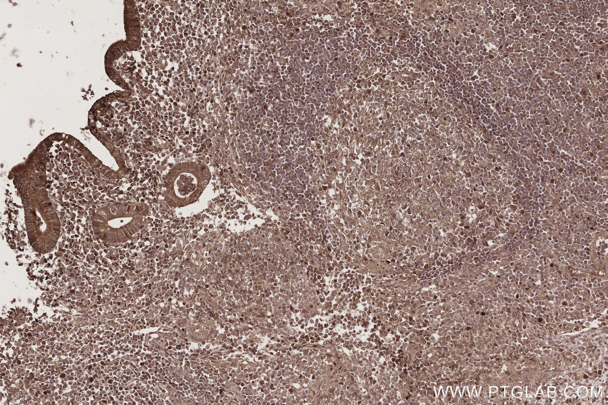 Immunohistochemical analysis of paraffin-embedded human appendicitis tissue slide using KHC2787 (CCDC99 IHC Kit).