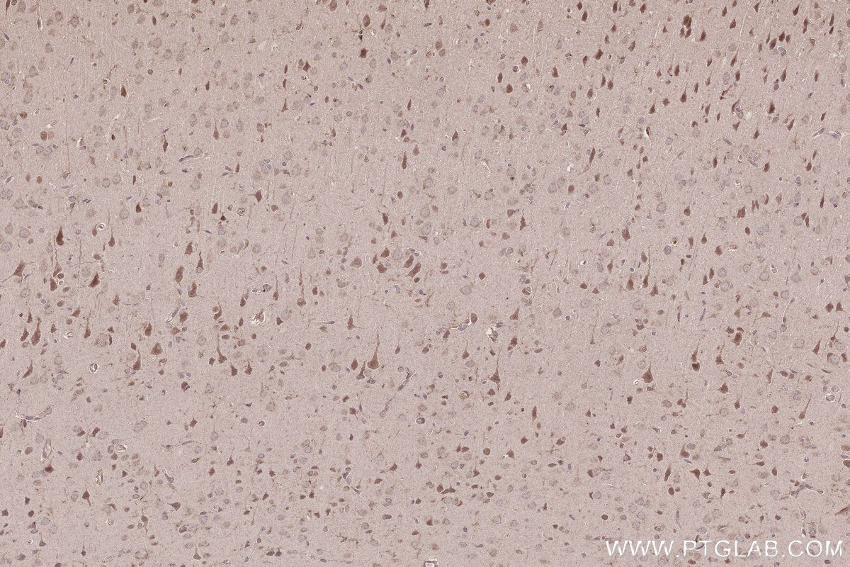 Immunohistochemical analysis of paraffin-embedded rat brain tissue slide using KHC2787 (CCDC99 IHC Kit).