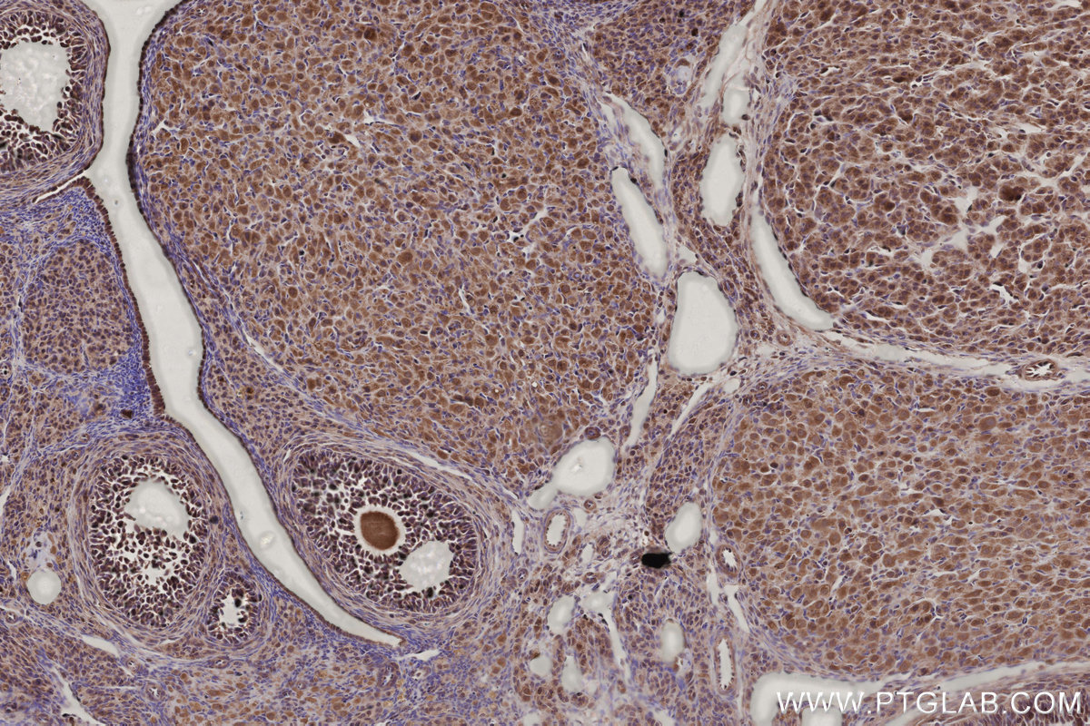 Immunohistochemical analysis of paraffin-embedded rat ovary tissue slide using KHC2787 (CCDC99 IHC Kit).