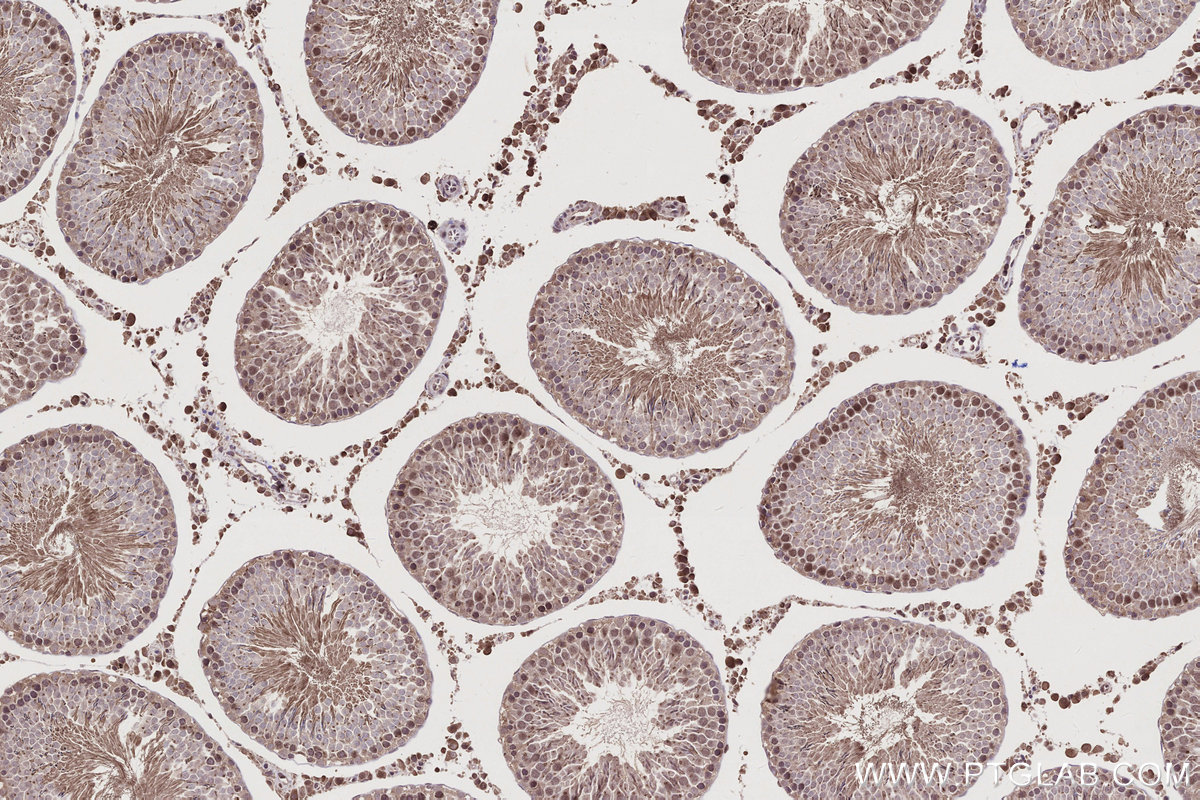 Immunohistochemical analysis of paraffin-embedded rat testis tissue slide using KHC2787 (CCDC99 IHC Kit).