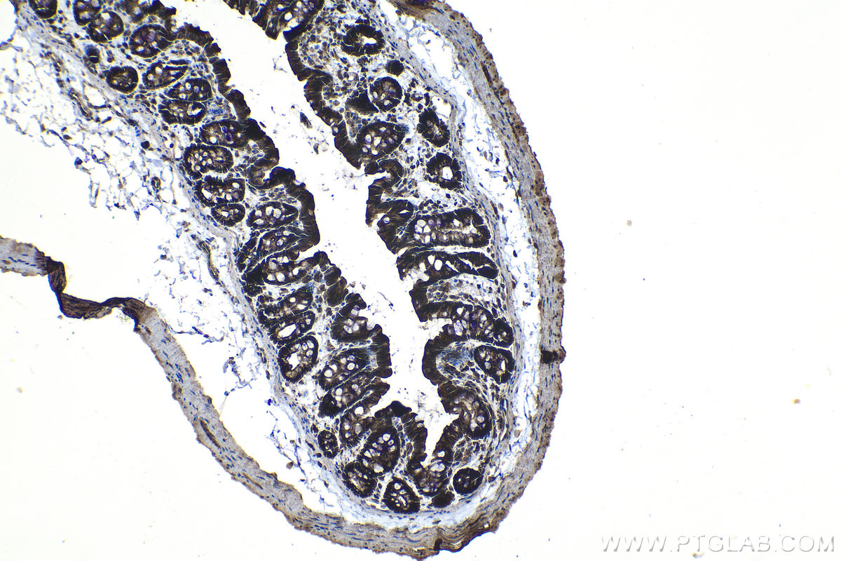 Immunohistochemical analysis of paraffin-embedded rat colon tissue slide using KHC1174 (CCM3/PDCD10 IHC Kit).