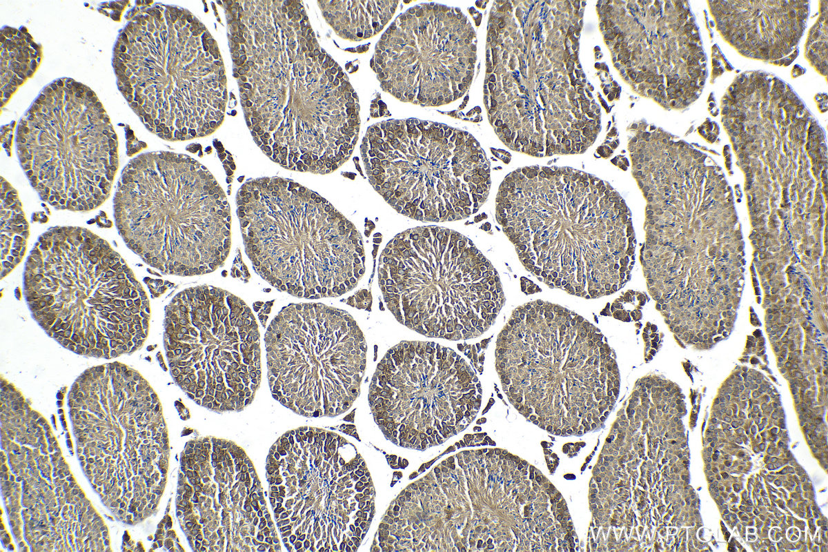 Immunohistochemical analysis of paraffin-embedded mouse testis tissue slide using KHC2132 (CCNB2 IHC Kit).