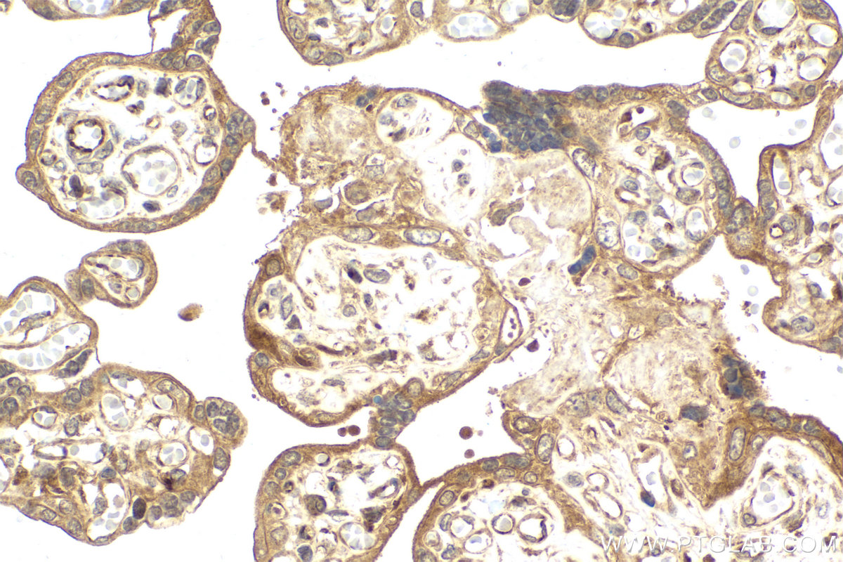 Immunohistochemical analysis of paraffin-embedded human placenta tissue slide using KHC2132 (CCNB2 IHC Kit).