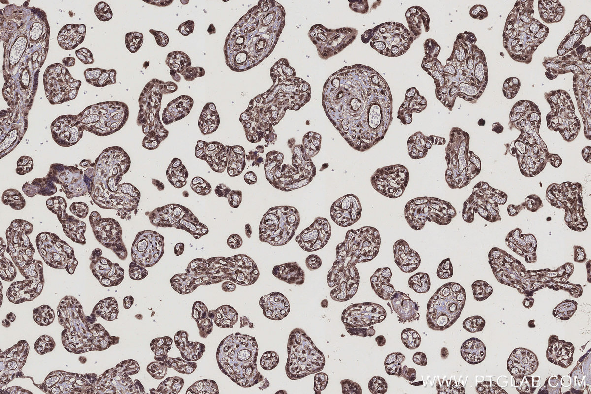 Immunohistochemical analysis of paraffin-embedded human placenta tissue slide using KHC3127 (CCNI2 IHC Kit).