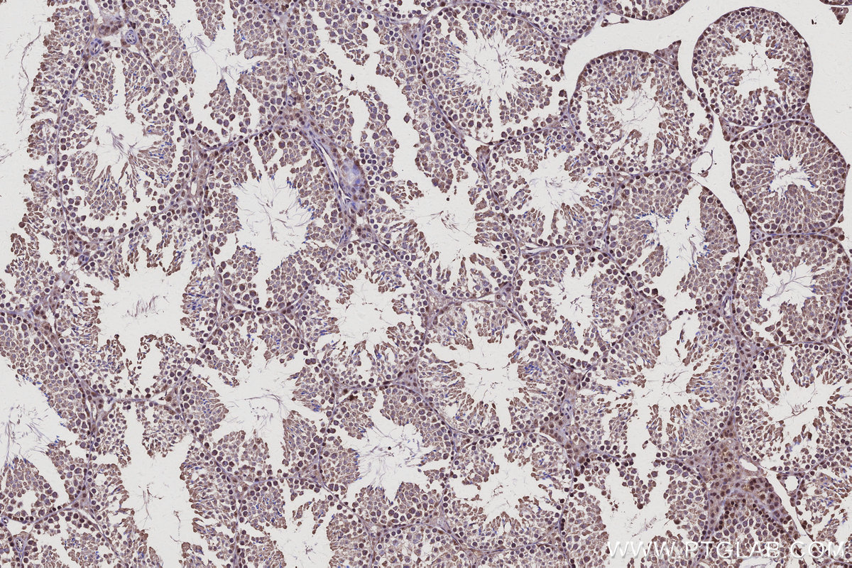 Immunohistochemical analysis of paraffin-embedded mouse testis tissue slide using KHC3126 (CCNJ IHC Kit).