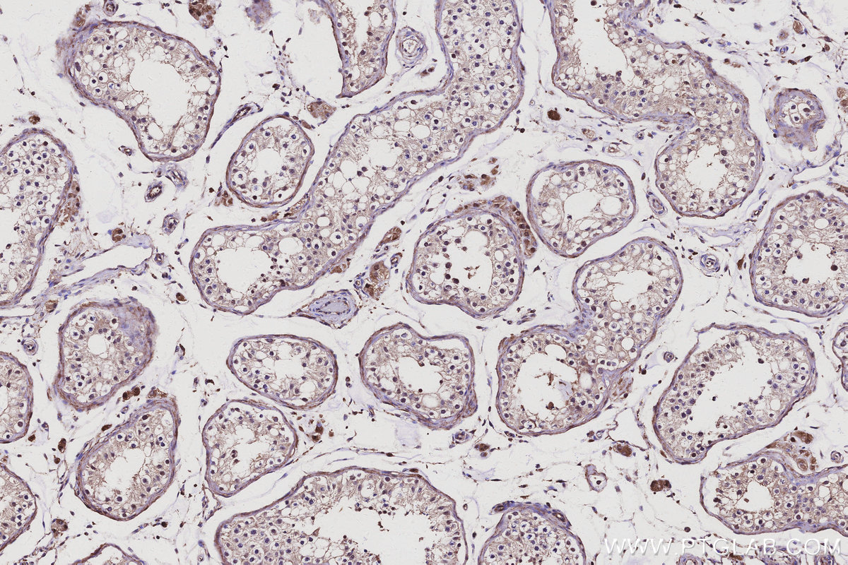 Immunohistochemical analysis of paraffin-embedded human testis tissue slide using KHC3126 (CCNJ IHC Kit).