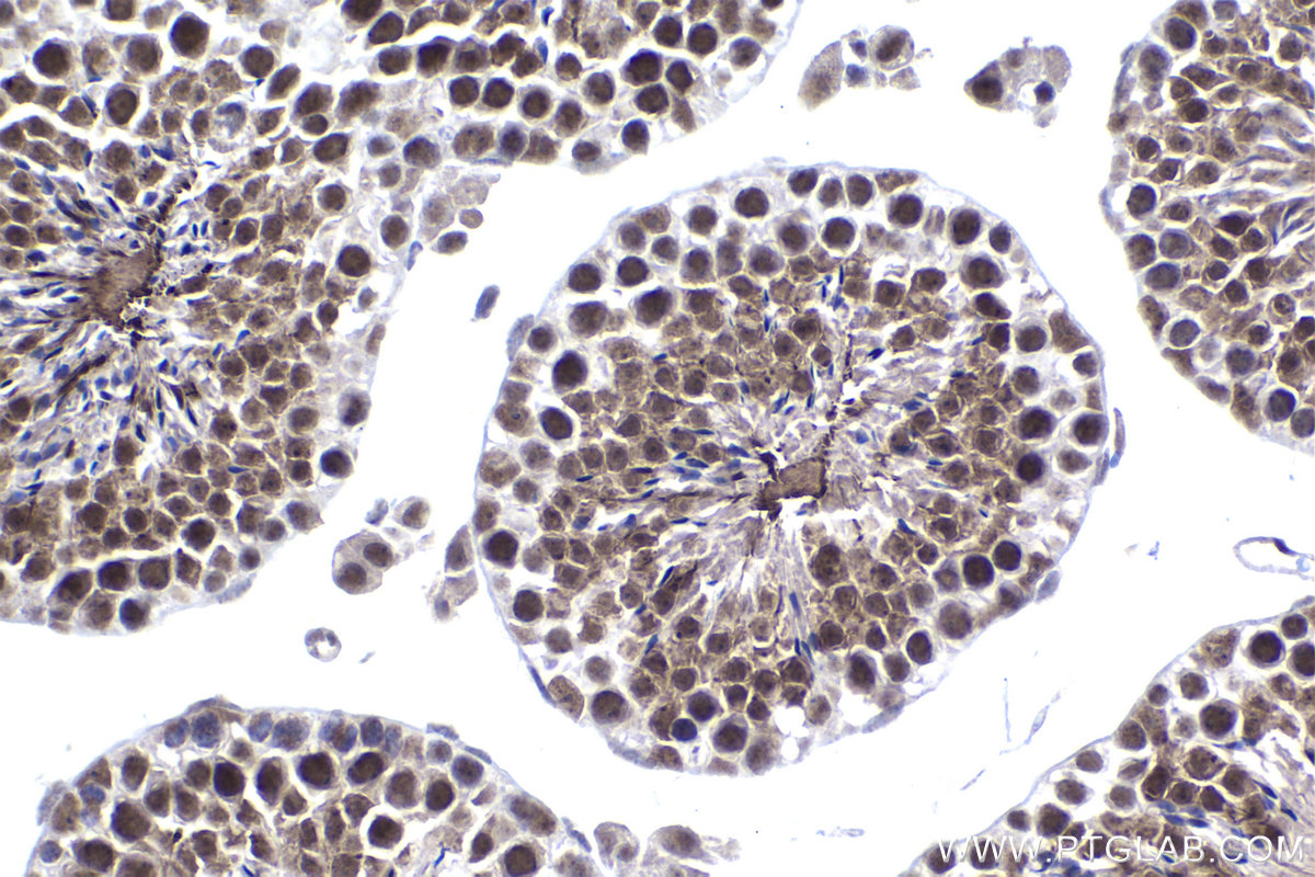 Immunohistochemical analysis of paraffin-embedded mouse testis tissue slide using KHC1479 (CCNK IHC Kit).