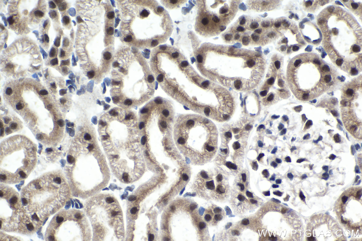 Immunohistochemical analysis of paraffin-embedded rat kidney tissue slide using KHC1479 (CCNK IHC Kit).