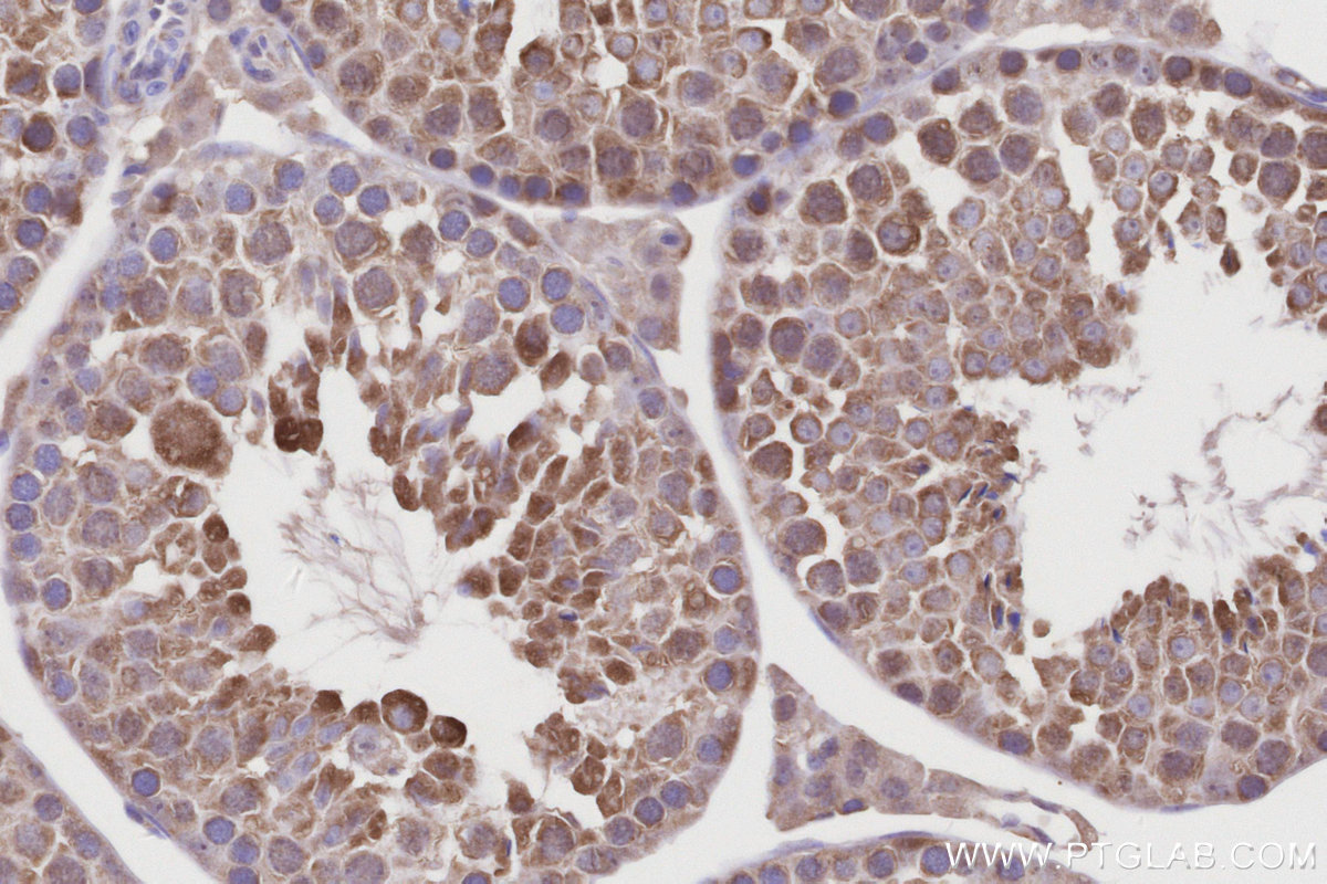 Immunohistochemical analysis of paraffin-embedded mouse testis tissue slide using KHC3222 (CCT4 IHC Kit).