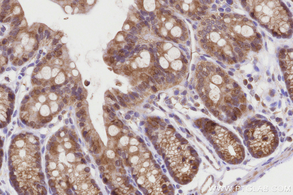 Immunohistochemical analysis of paraffin-embedded mouse colon tissue slide using KHC3222 (CCT4 IHC Kit).