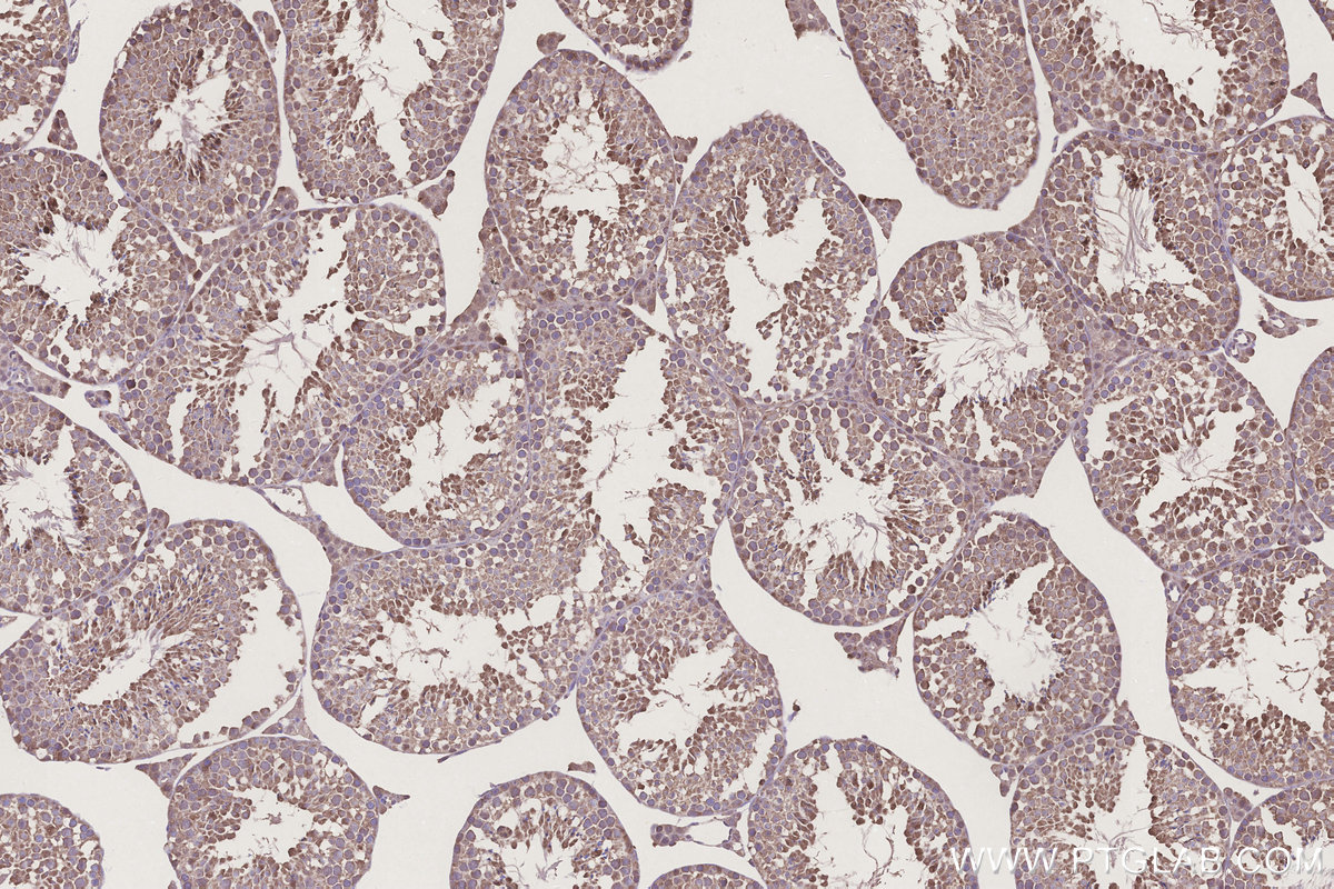 Immunohistochemical analysis of paraffin-embedded mouse testis tissue slide using KHC3304 (CCT6B IHC Kit). Immunohistochemical analysis of paraffin-embedded mouse testis tissue slide using KHC3304 (CCT6B IHC Kit).