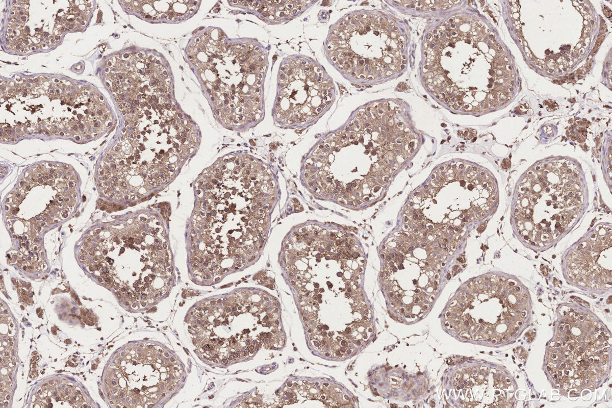 Immunohistochemical analysis of paraffin-embedded human testis tissue slide using KHC3304 (CCT6B IHC Kit). Immunohistochemical analysis of paraffin-embedded human testis tissue slide using KHC3304 (CCT6B IHC Kit).