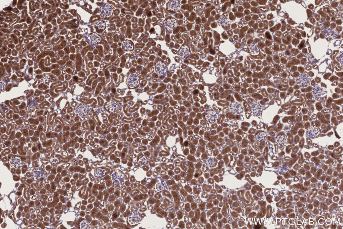 Immunohistochemical analysis of paraffin-embedded mouse kidney tissue slide using KHC3304 (CCT6B IHC Kit). Immunohistochemical analysis of paraffin-embedded mouse kidney tissue slide using KHC3304 (CCT6B IHC Kit).