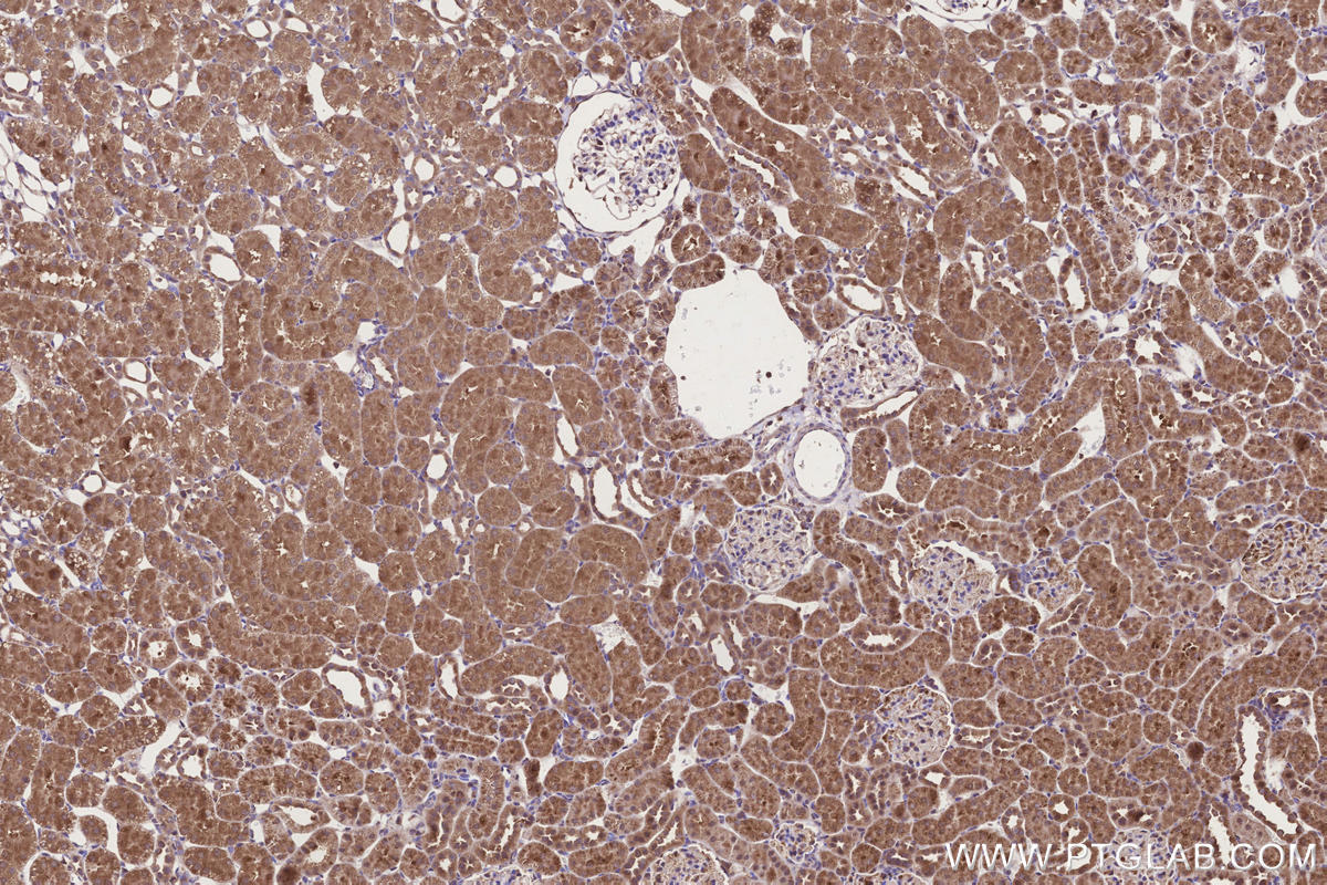 Immunohistochemical analysis of paraffin-embedded rat kidney tissue slide using KHC3304 (CCT6B IHC Kit). Immunohistochemical analysis of paraffin-embedded rat kidney tissue slide using KHC3304 (CCT6B IHC Kit).