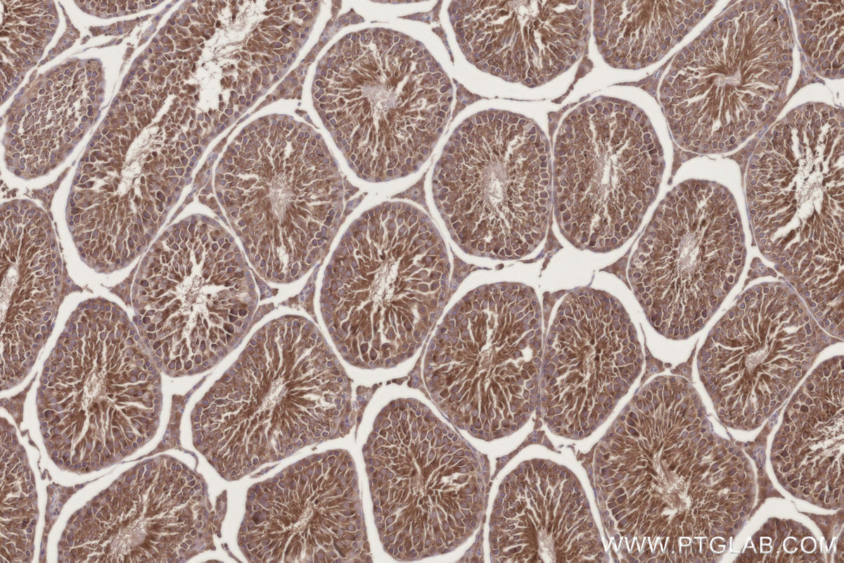Immunohistochemical analysis of paraffin-embedded rat testis tissue slide using KHC3304 (CCT6B IHC Kit). Immunohistochemical analysis of paraffin-embedded rat testis tissue slide using KHC3304 (CCT6B IHC Kit).