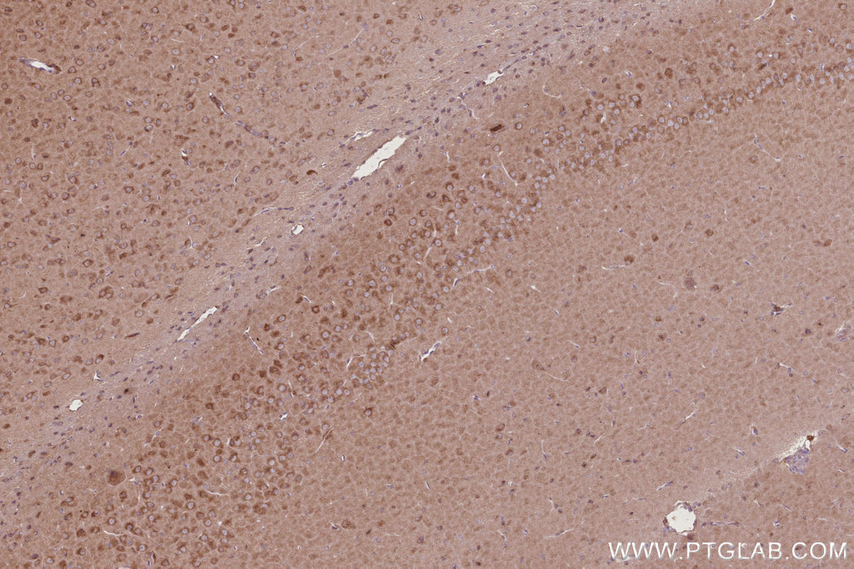 Immunohistochemical analysis of paraffin-embedded rat brain tissue slide using KHC2849 (CCT7 IHC Kit).