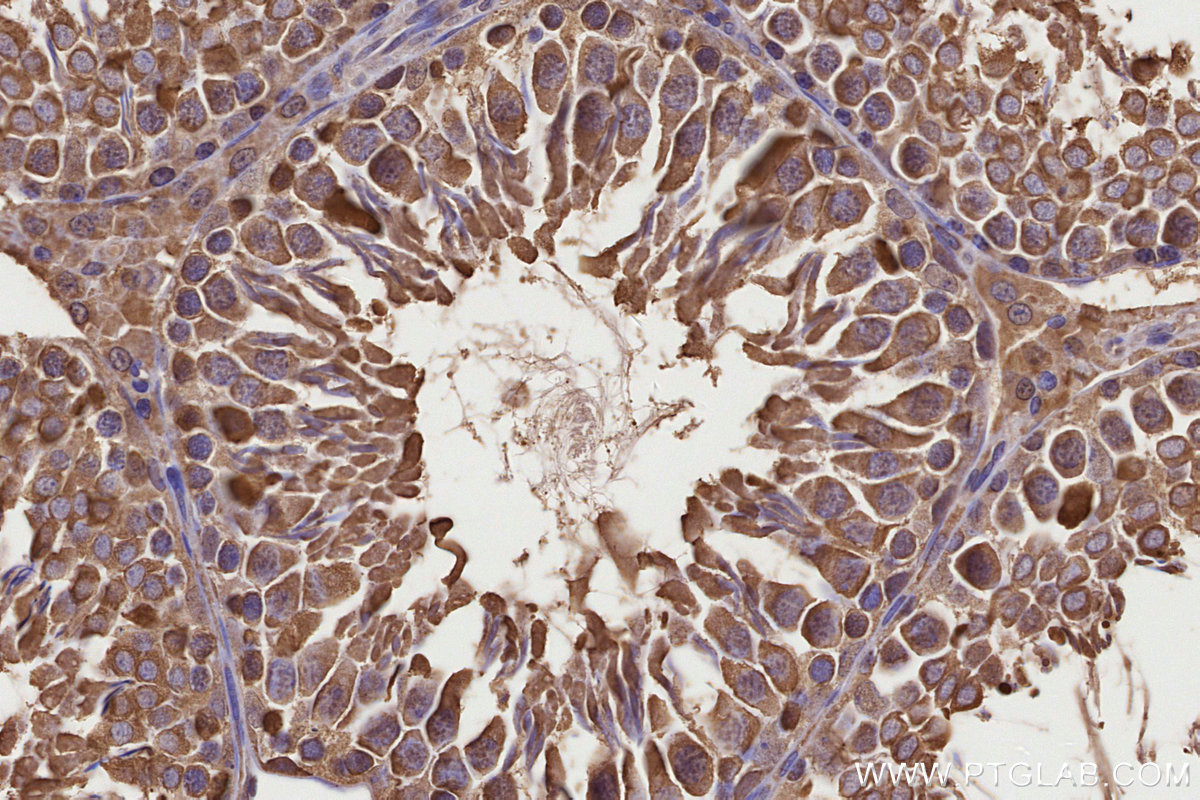 Immunohistochemical analysis of paraffin-embedded rat testis tissue slide using KHC3221 (CCT8 IHC Kit). Immunohistochemical analysis of paraffin-embedded rat testis tissue slide using KHC3221 (CCT8 IHC Kit).
