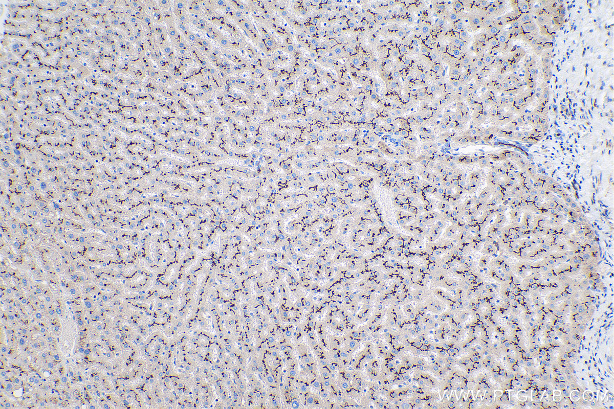 Immunohistochemical analysis of paraffin-embedded human liver tissue slide using KHC0386 (CD10 IHC Kit).