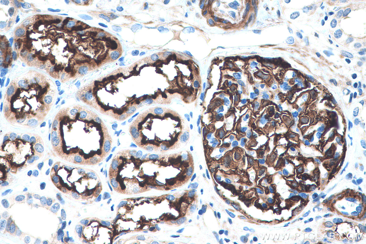 Immunohistochemical analysis of paraffin-embedded human renal cell carcinoma tissue(NAT) slide using KHC0386 (CD10 IHC Kit).