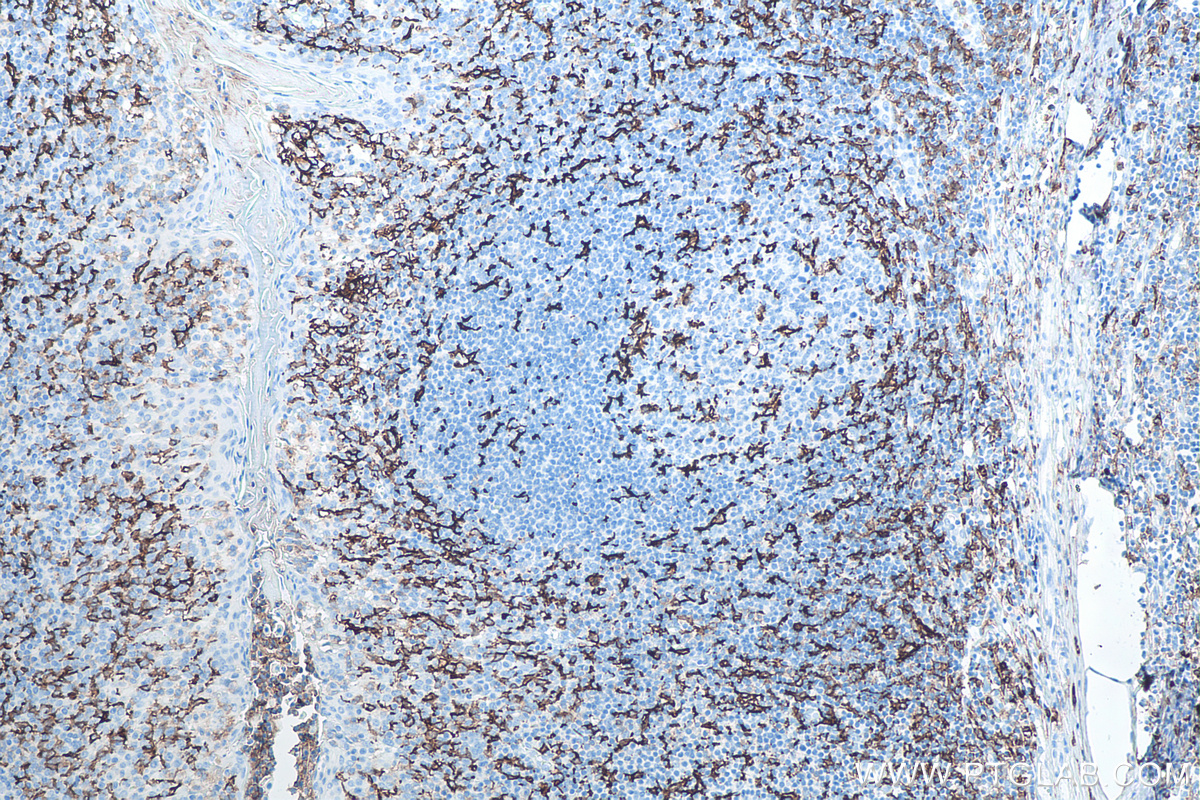 Immunohistochemical analysis of paraffin-embedded human tonsillitis tissue slide using KHC0017 (CD11c IHC Kit).