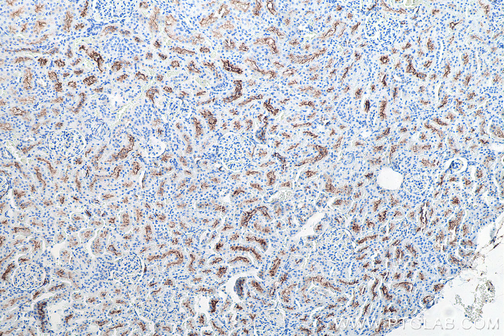 Immunohistochemical analysis of paraffin-embedded rat kidney tissue slide using KHC0026 (CD13 IHC Kit).