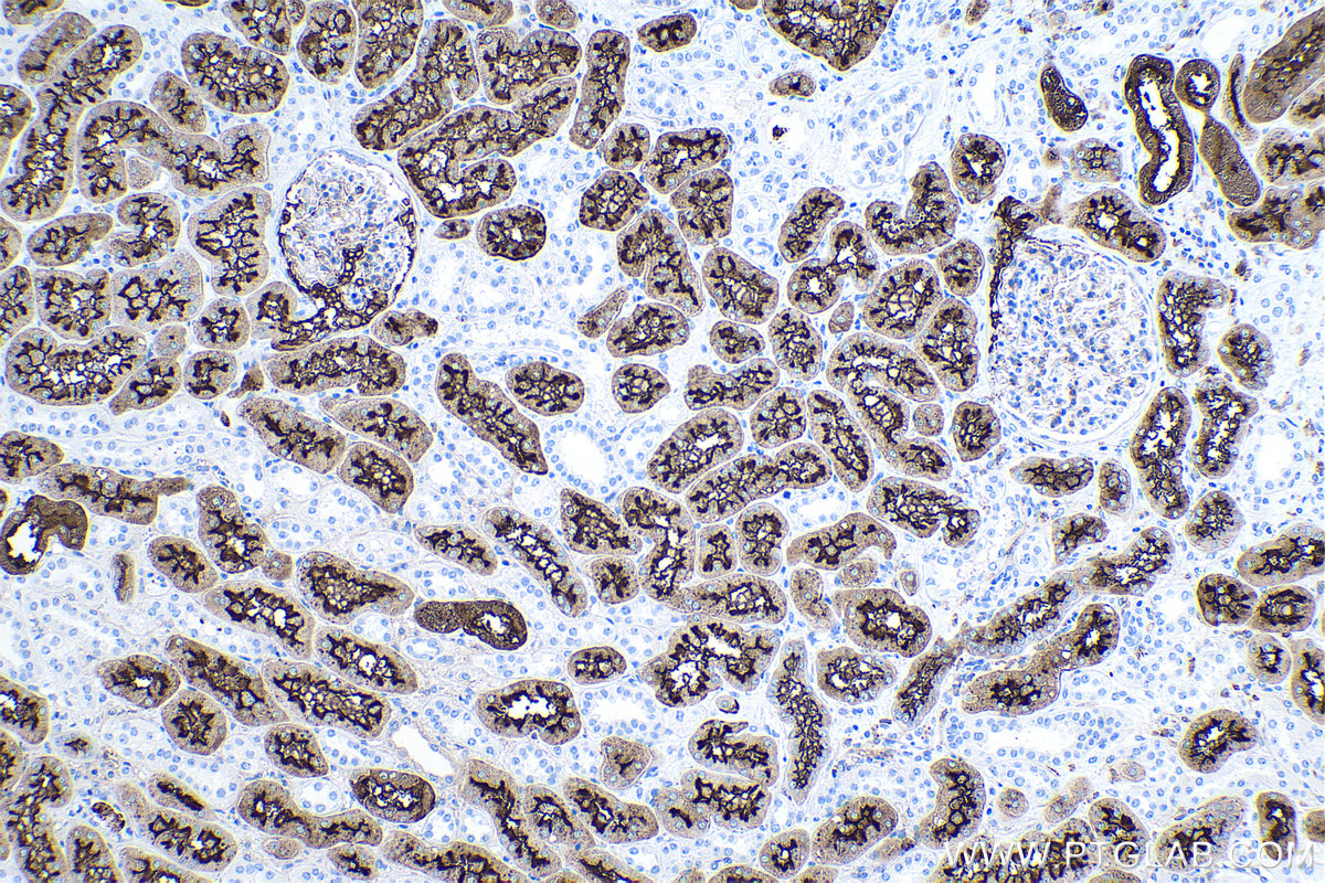 Immunohistochemical analysis of paraffin-embedded human kidney tissue slide using KHC0026 (CD13 IHC Kit).