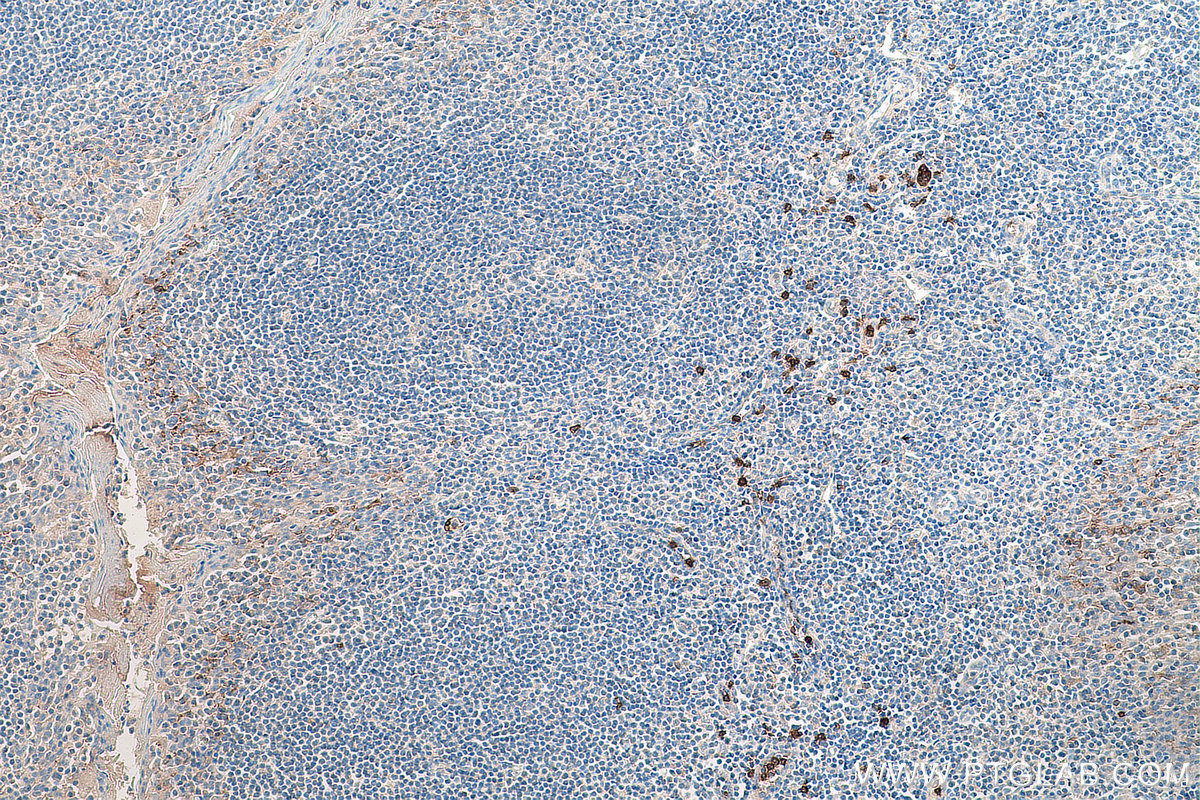 Immunohistochemical analysis of paraffin-embedded human tonsillitis tissue slide using KHC0029 (CD16 IHC Kit).