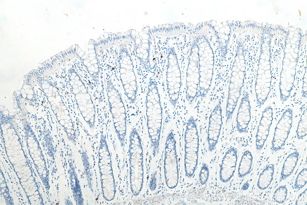 Immunohistochemical analysis of paraffin-embedded human colon tissue slide using KHC0018 (CD20 IHC Kit).