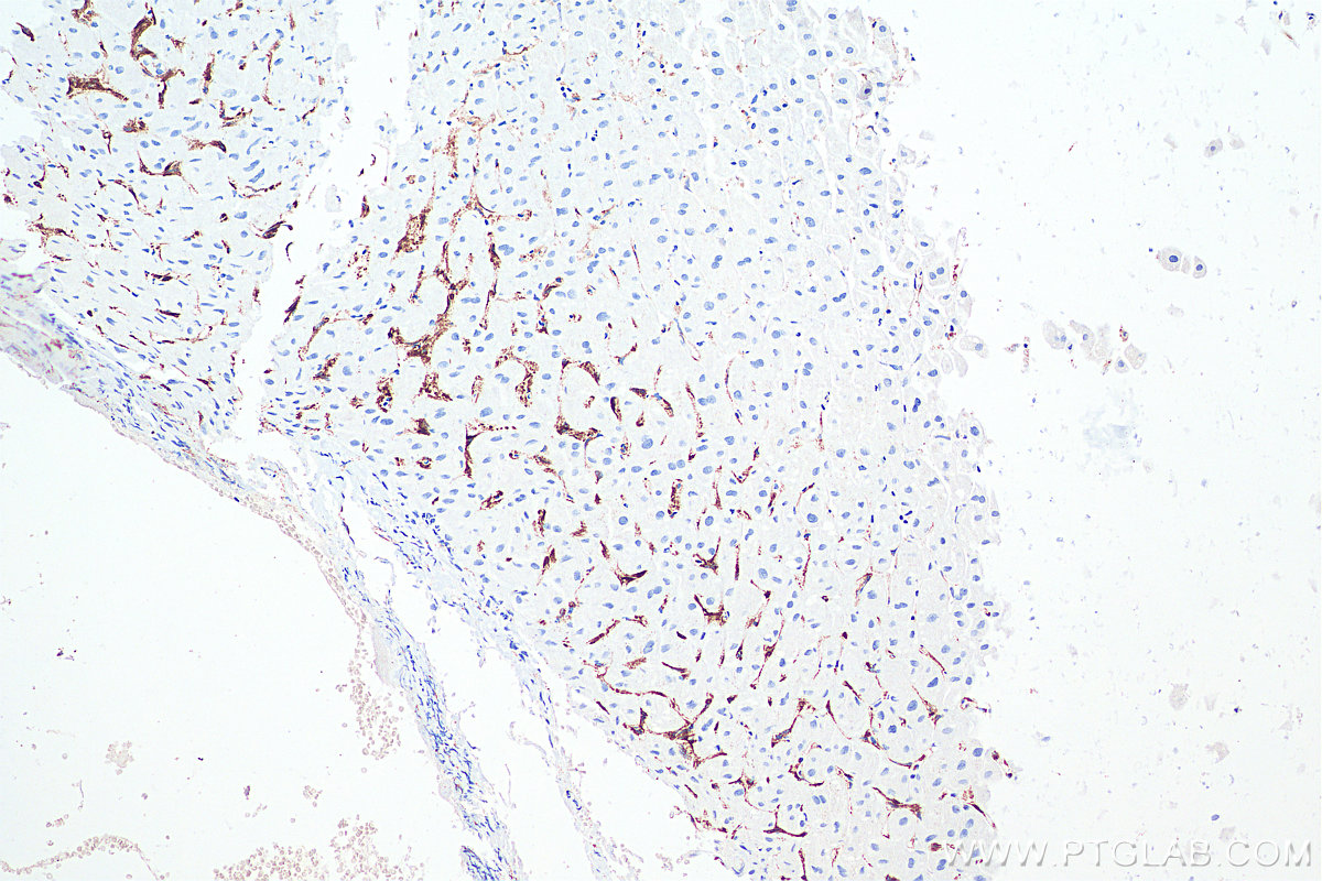 Immunohistochemical analysis of paraffin-embedded human liver tissue slide using KHC0007 (CD206 IHC Kit).