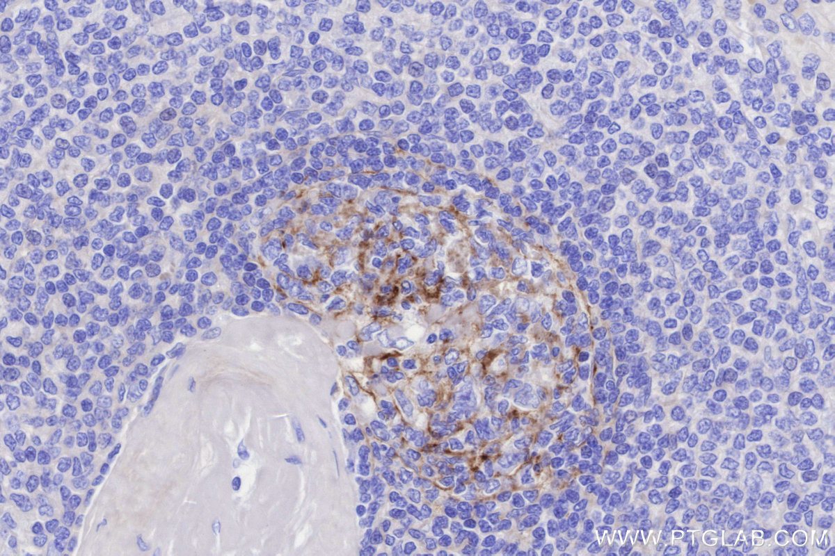 Immunohistochemical analysis of paraffin-embedded human spleen tissue slide using KHC3310 (CD21 IHC Kit).