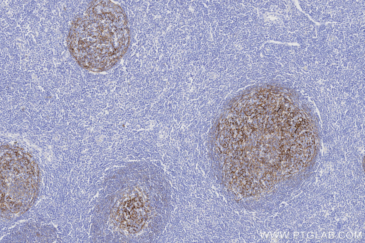 Immunohistochemical analysis of paraffin-embedded human tonsillitis tissue slide using KHC3310 (CD21 IHC Kit). Immunohistochemical analysis of paraffin-embedded human tonsillitis tissue slide using KHC3310 (CD21 IHC Kit).