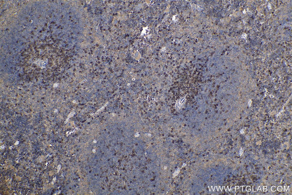 Immunohistochemical analysis of paraffin-embedded mouse spleen tissue slide using KHC0608 (CD247 IHC Kit).