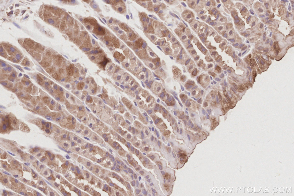 Immunohistochemical analysis of paraffin-embedded mouse stomach tissue slide using KHC3079 (CD2AP IHC Kit). Immunohistochemical analysis of paraffin-embedded mouse stomach tissue slide using KHC3079 (CD2AP IHC Kit).