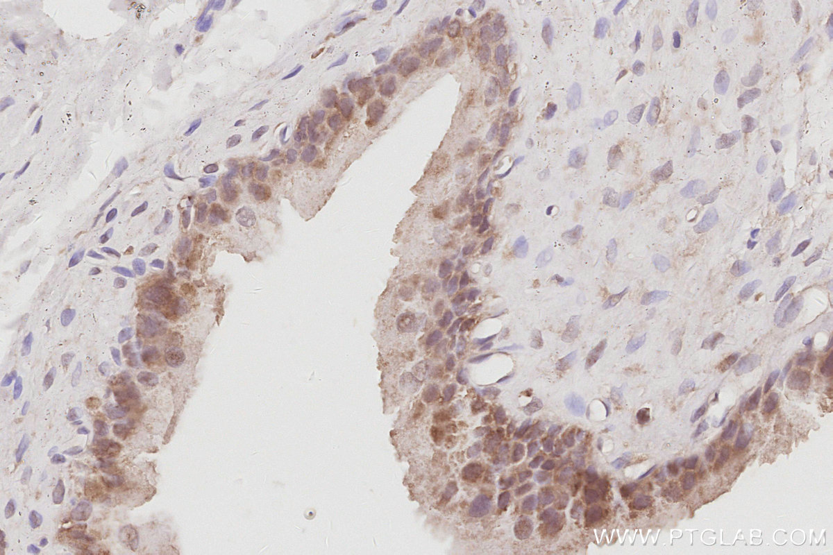 Immunohistochemical analysis of paraffin-embedded rat bladder tissue slide using KHC3079 (CD2AP IHC Kit). Immunohistochemical analysis of paraffin-embedded rat bladder tissue slide using KHC3079 (CD2AP IHC Kit).