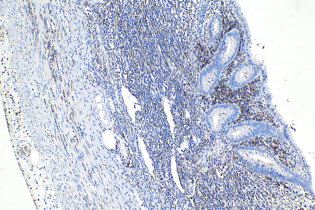 Immunohistochemical analysis of paraffin-embedded human appendicitis tissue slide using KHC1119 (CD38 IHC Kit).