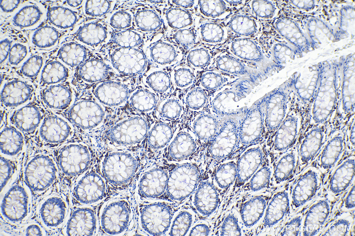 Immunohistochemical analysis of paraffin-embedded human colon tissue slide using KHC1119 (CD38 IHC Kit).